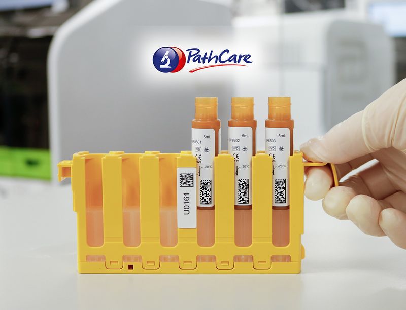 Abbott Ailinity IA Plus vials in an onboard quality control rack